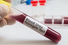 Blood test vial representing BUN blood test measuring blood urea nitrogen for kidney function assessment