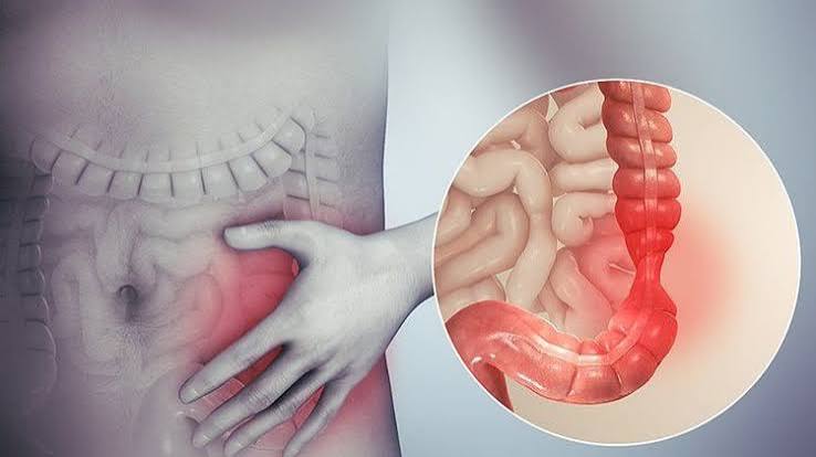 celiac disease gluten-free diet treatment villous healing follow-up serology