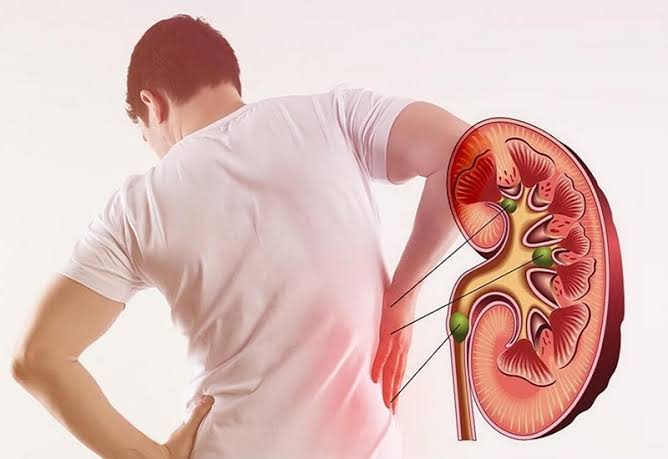 Overview of chronic kidney disease causes complications and treatment including diabetes hypertension and SGLT2 inhibitors