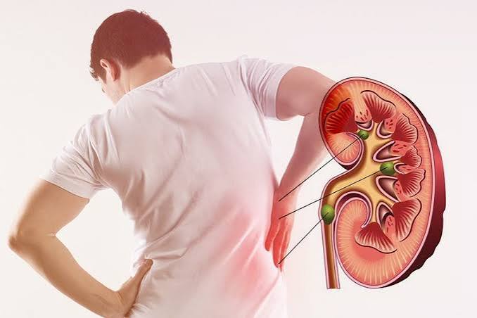 CKD stage progression monitoring schedule by eGFR level