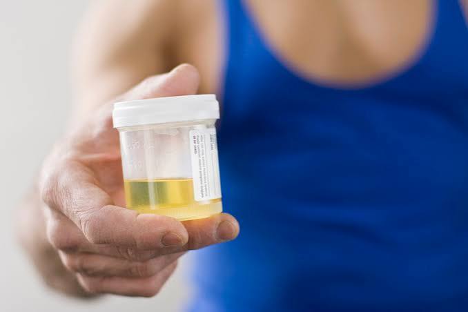 cloudy urine what it may indicate uti phosphaturia kidney guide