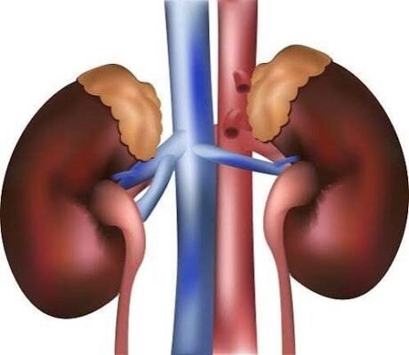 Diagram showing the most common kidney problems in adults including CKD kidney stones and infections