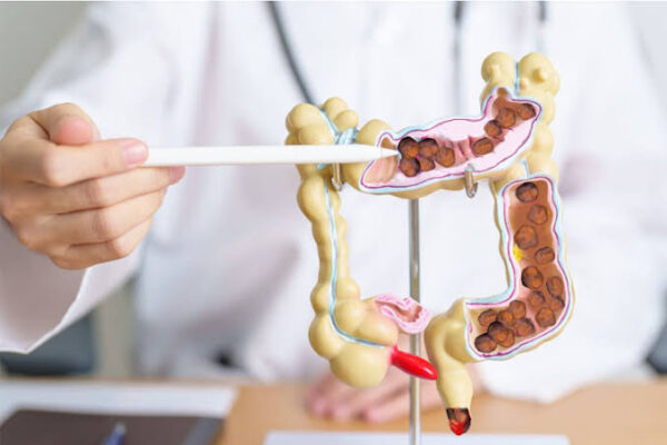 constipation symptoms causes and prevention — fiber intake, medications, and health conditions affecting bowel regularity