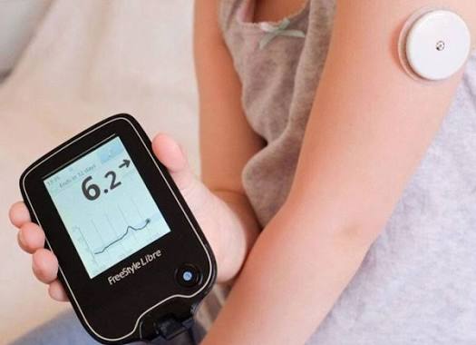 comparison showing CGM glucose curve over 24 hours with meal spikes exercise dips and overnight patterns versus isolated fingerstick readings