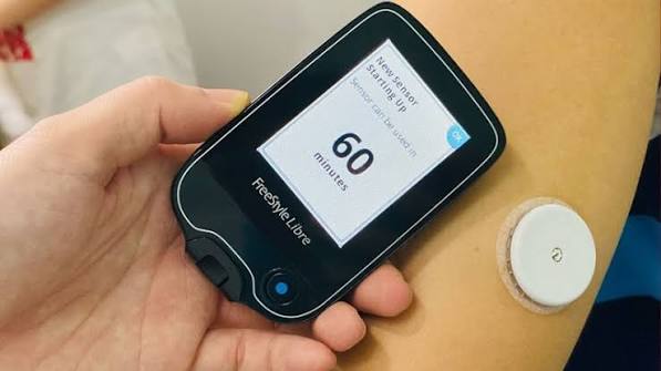 continuous glucose monitor sensor on upper arm with smartphone displaying real-time glucose reading and trend arrow