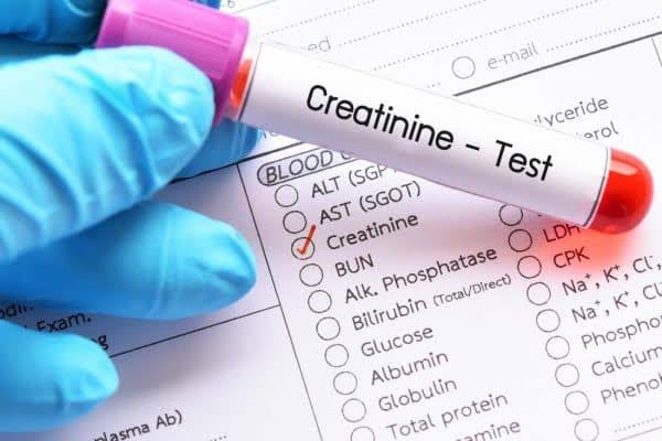 Blood test tube for creatinine blood test showing kidney function measurement and normal creatinine levels
