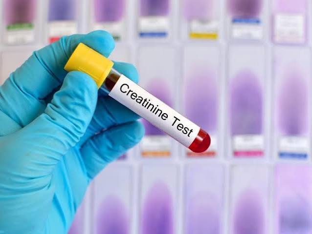 Laboratory blood panel results showing creatinine and BUN levels used to assess kidney function and eGFR