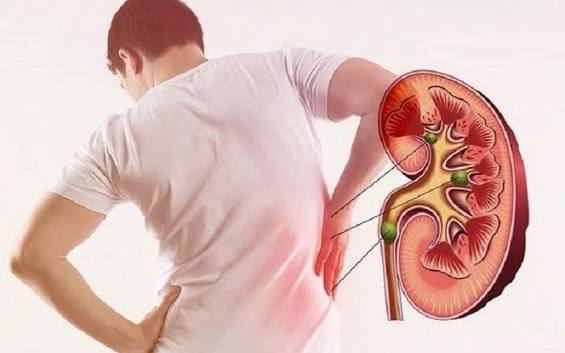 diabetic kidney disease progression — diagram showing the five stages from hyperfiltration and microalbuminuria through macroalbuminuria to end-stage kidney disease requiring dialysis
