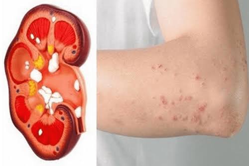 Guide to early kidney problem warning signs and what steps to take for evaluation and follow-up