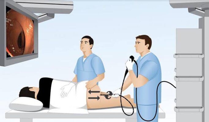 endoscopy what patients should know — gastroscopy OGD flexible endoscope oesophagus stomach duodenum