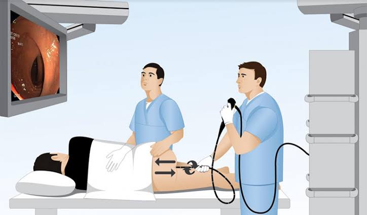 endoscopy what patients should know — gastroscopy OGD flexible endoscope oesophagus stomach duodenum