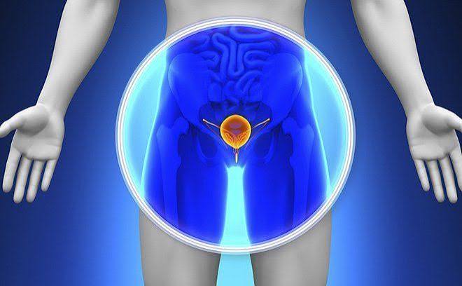 Enlarged prostate and urination problems — medical illustration showing BPH effect on urethral lumen diameter causing urinary hesitancy and weak stream in aging men