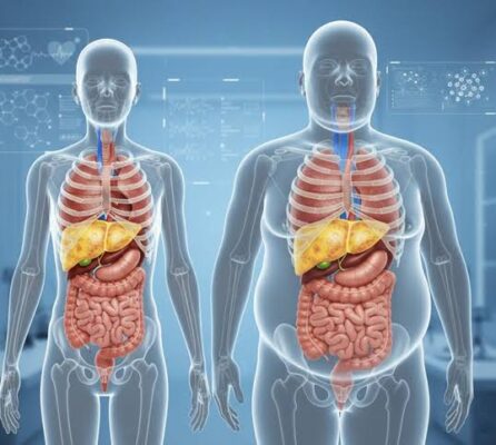 Person doing aerobic exercise showing direct benefits for fatty liver health including reduced hepatic fat content and improved liver enzymes