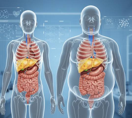 Person doing aerobic exercise showing direct benefits for fatty liver health including reduced hepatic fat content and improved liver enzymes