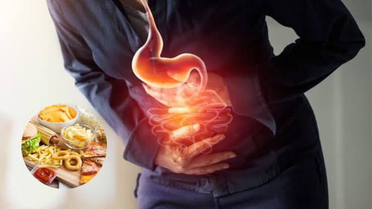 Fried foods, butter, and fatty meats — dietary sources that trigger acid reflux by relaxing the lower esophageal sphincter