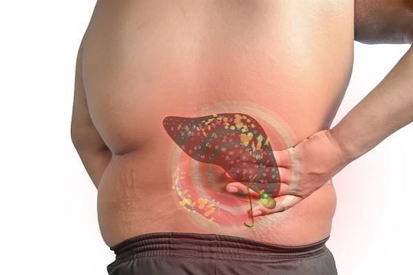 fatty-liver-and-obesity-body — bariatric surgery MASLD liver fibrosis regression weight loss GLP-1 semaglutide