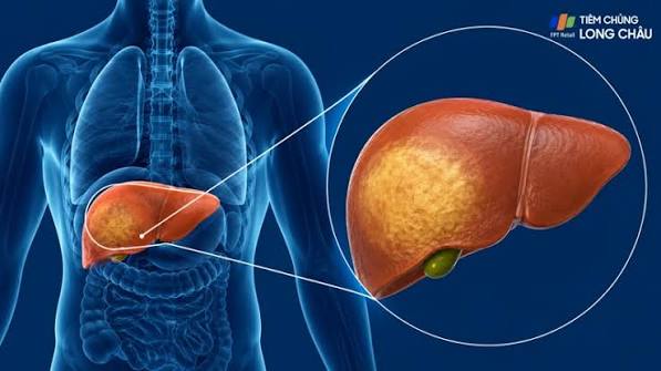 fatty-liver-causes-risk-factors-body — MASLD metabolic syndrome risk factors obesity diabetes dyslipidaemia hypertension genetics