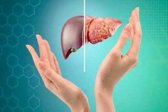 fatty-liver-symptoms-testing-body — fatty liver testing pathway FIB-4 FibroScan liver biopsy blood tests monitoring