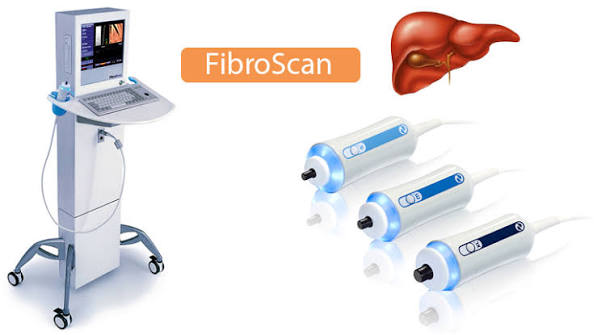 fibroscan-a-simple-guide-body — FibroScan probe intercostal space liver fibrosis measurement kPa result screen