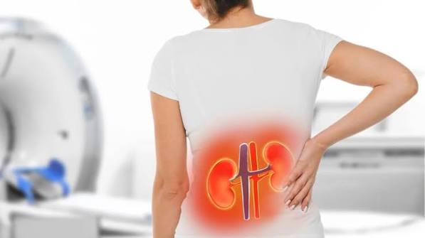 flank pain kidney related causes stones infection infarction guide