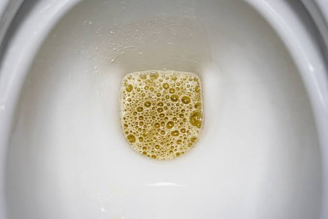 foamy urine proteinuria uacr kidney damage causes