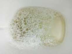 foamy urine what it may mean proteinuria kidney guide