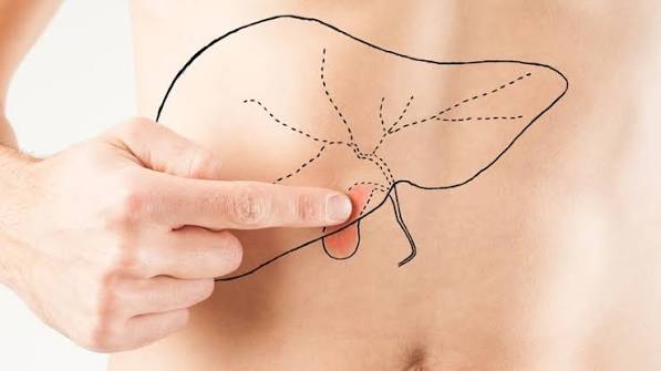 gallbladder pain what it feels like biliary colic location radiation shoulder RUQ symptoms cholecystitis