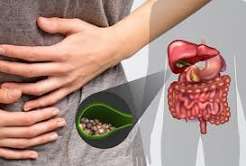 gallstones symptoms and causes biliary colic cholesterol stones cholecystitis jaundice diagnosis ultrasound