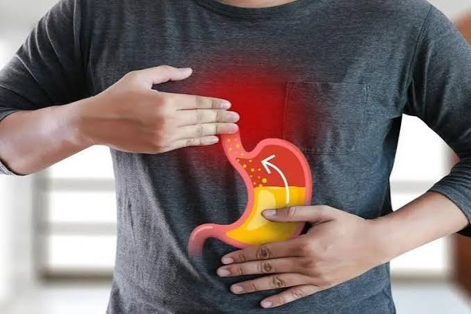 GERD a simple guide for adults — diagnosis treatment and long-term management