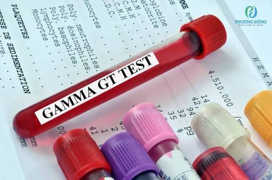 GGT test and liver health — gamma-glutamyl transferase elevated causes liver alcohol cholestasis