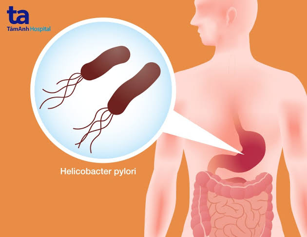 H. pylori infection stomach bacteria gastric mucosa colonisation mechanism