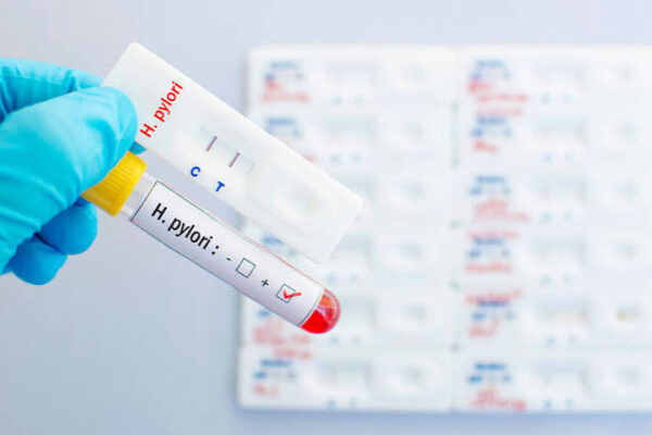 H pylori test what it shows — urea breath test stool antigen serology biopsy peptic ulcer gastric cancer