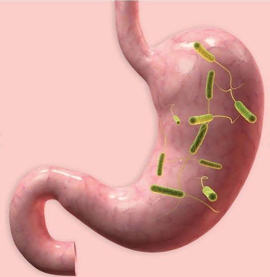 urea breath test for H. pylori diagnosis non-invasive testing method