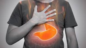 heartburn-what-adults-should-know-body — causes of heartburn and GERD including LES dysfunction and triggers