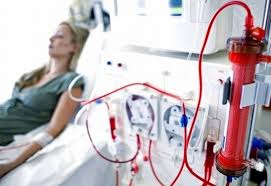 hemodialysis explained — dialysis machine with blood circuit and dialyzer filter for kidney failure treatment