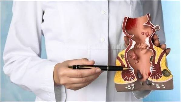 Person enjoying a high-fibre meal with vegetables, legumes and whole grains — a key prevention strategy for hemorrhoids