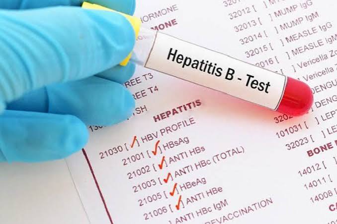 hepatitis blood tests explained — hepatitis A B C serology viral load antibody testing diagnosis