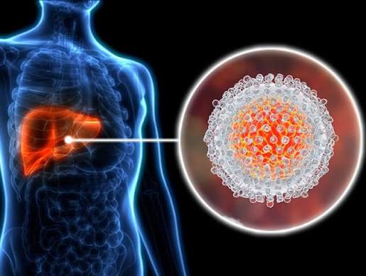 hepatitis C symptoms testing and treatment HCV RNA direct-acting antivirals DAA cure SVR liver disease