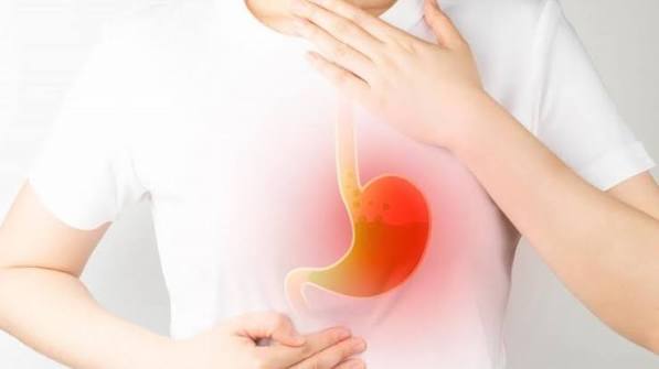 hiatal hernia types sliding para-oesophageal acid reflux GERD symptoms treatment