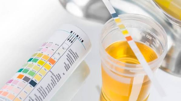 home kidney health monitoring what to track — structured home monitoring log showing blood pressure, weight, symptoms and medication records for CKD patient