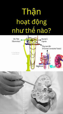 Diagram showing how the kidneys work with nephron anatomy and filtration structures labeled