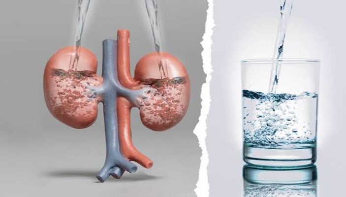 hydration kidney health water intake CKD kidney stones vasopressin fluid intake