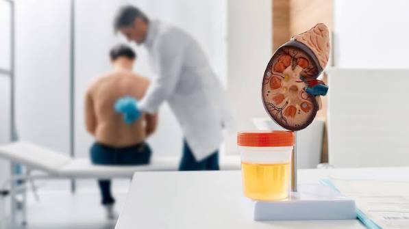 Doctor reviewing kidney function test results with blood and urine analysis panels