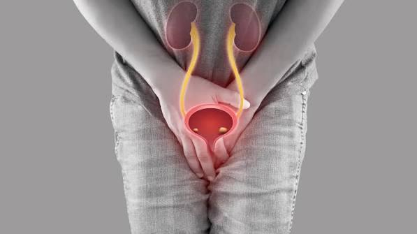 Incomplete bladder emptying — man experiencing discomfort from urinary retention illustrating the sensation of incomplete void from BPH obstruction or detrusor underactivity