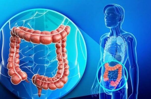 irritable bowel syndrome IBS symptoms abdominal pain bowel habit change gut-brain disorder functional GI