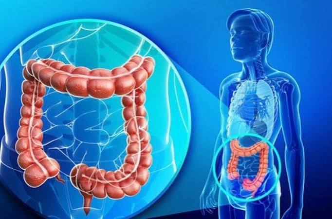 irritable bowel syndrome IBS symptoms abdominal pain bowel habit change gut-brain disorder functional GI