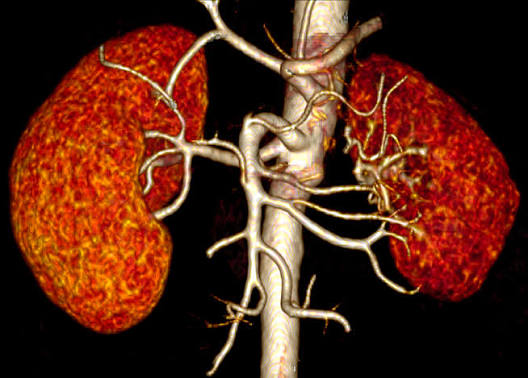 kidney disease and high blood pressure — nephrologist reviewing blood pressure log and medication regimen with CKD patient