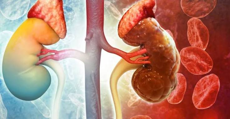kidney disease and long-term monitoring — nephrologist reviewing CKD lab trend chart with patient for eGFR and proteinuria tracking