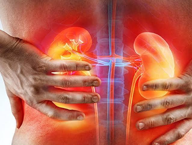 kidney stone pain what it feels like — diagram showing pain radiation pattern from flank to groin during renal colic from ureteral stone passage