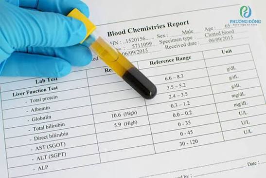 liver function tests explained — ALT AST bilirubin albumin ALP panel blood test interpretation
